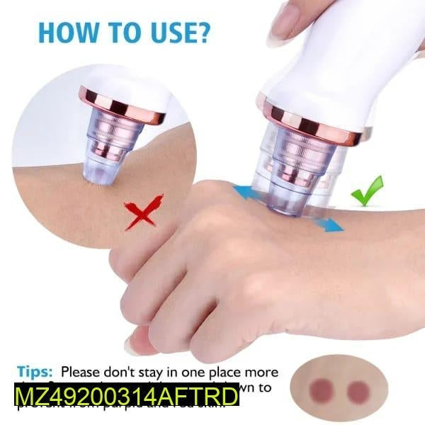 Vacuum Blackhead Remover