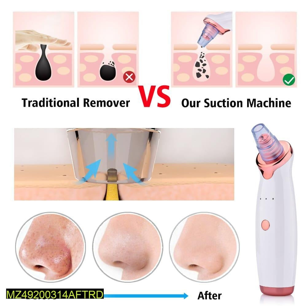 Vacuum Blackhead Remover
